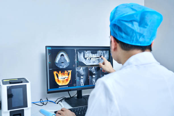 Best Knocked-Out Tooth (Avulsed Tooth) Treatment in Winnebago, MN